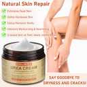 3 x Intensive Urea Hydrating Cream Gentle Urea & Salicylic Acid Lotion | Smooths Very Dry, Rough Skin on Heels, Elbows, Knees, Hands | Unscented Moisturizer 150ml