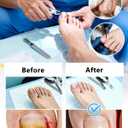 Heavy Duty Toenail Clippers for Thick Nails, Long Handle, Large Toe Nail Clippers for Seniors, 62 Pieces