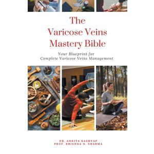 The Varicose Veins Mastery Bible: Your Blueprint for Complete Varicose Veins Management, Paperback