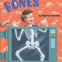 Bones