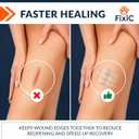 Fixic Butterfly Bandages - 2-Types Zip Wound Closure Strips - Ideal Wound Closure Kit - Sutures Free Butterfly Stitches Bandage - Stitches Kit with 4 Bandages, 4 Pads, and 4 Wipes Included!