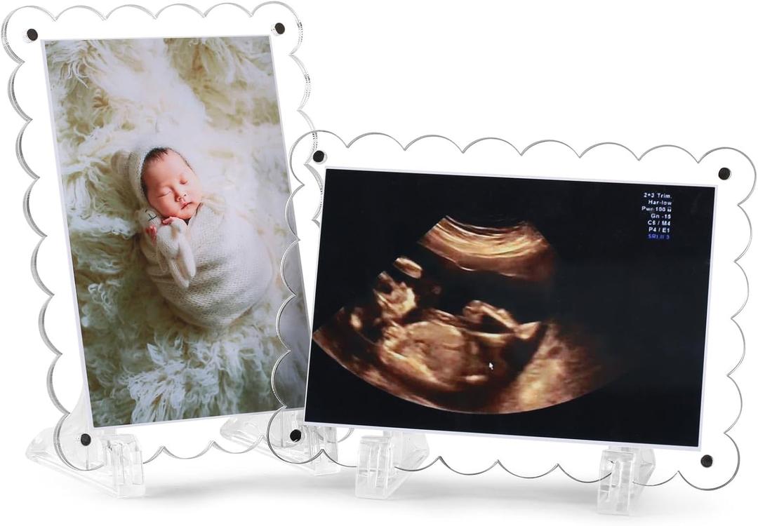 Sonogram Picture Frame Dual, Magnetic Ultrasound Frame with Stand - 2 Pack Clear Acrylic Scalloped Edge for Pregnancy Announcement, Baby Shower Gifts