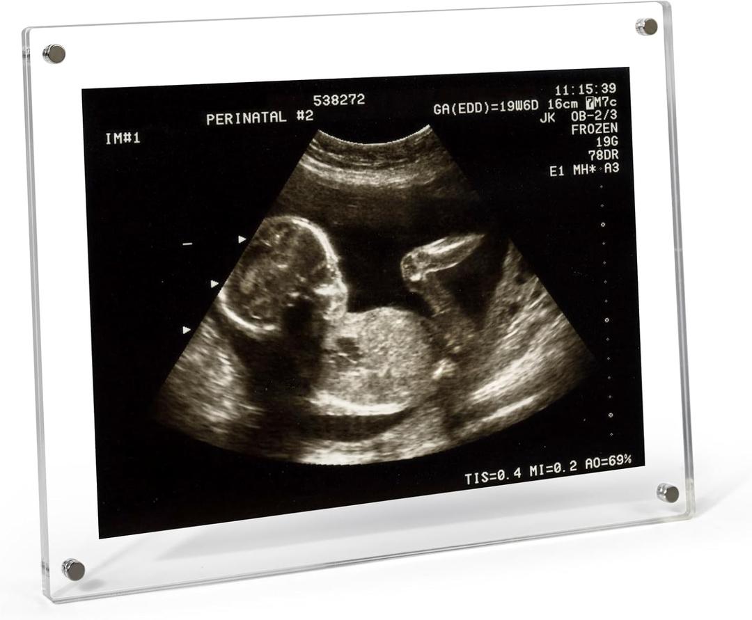 5x7 Ultrasound Picture Frame, Sonogram Picture Frame with Magnetic Back Clear Acrylic Baby Keepsake for Refrigerator, Pregnancy Announcement, Gender Reveal, New Mom Gift(Rectangle - No Stand)