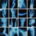 16 Pcs Realistic Broken Bones X-Ray Set - Blue & Black Skeleton X-Rays for Kids (9.8"x9.8") - Pretend Play Doctor Kit Learning Toy, Halloween & Medical School Supplies