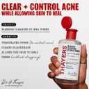 Thayers Blemish Clearing Salicylic Acid Toner, Acne Treatment Face Toner with 2% Salicylic Acid, Soothing and Non-Stripping Skin Care, 12 Fl Oz
