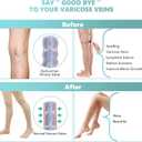 Compression Pantyhose for Women, 20-30 mmHg Footless Medical Compression Stockings, Waist High Opaque Graduated Support Compression Hose Tights for Edema, Varicose Veins, Swelling, Beige (XXL)