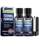 Tobcharm Toenail Fungus Treatment : Nail Fungus Treatment Extra Strength with Tea Tree Oil - Fast Acting Fungal Nail Solution with Undecylenic Acid for Toenails and Fingernails (2pack, 1fl oz each)