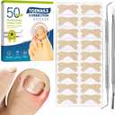 Ingrown Toenail Treatment, 60 Pcs Breathable Ingrown Toenail Strips