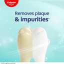 Colgate Baking Soda and Peroxide Whitening Toothpaste Gel, 3 Pack, Fluoride Formulated, Removes Surface Stains, Frosty Mint Stripe, 6 oz
