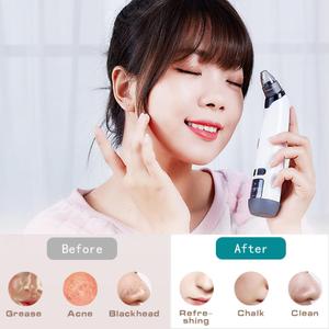 Black Head Remover for Face,Electric Three-Speed Adjustable Heating Blackhead Remover with 4 Different Sizes Suction Tips,LED Display Pore Vacuum Suitable for Oily,Neutral,Dry Skin