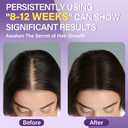 5% Minoxidil Foam for Women