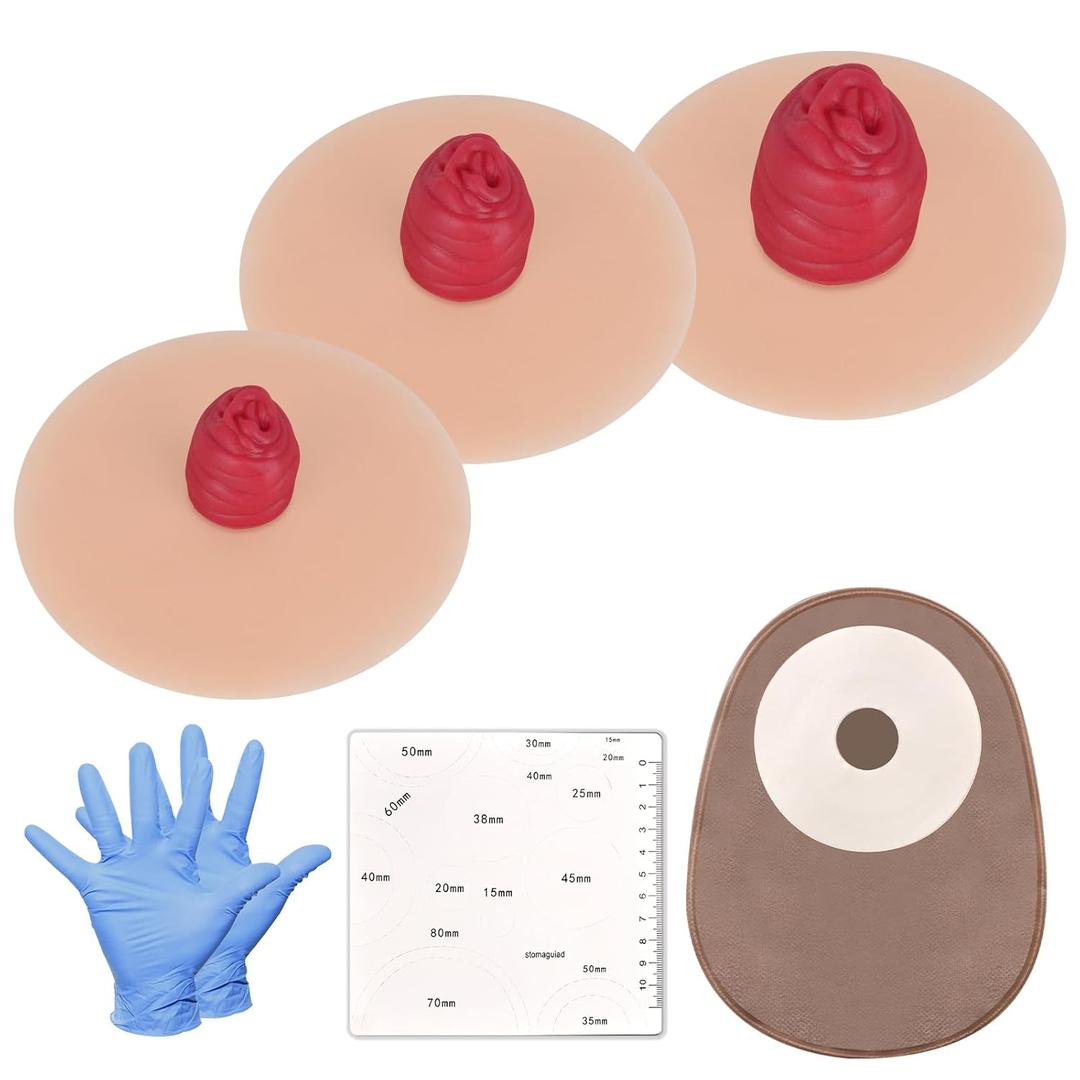 MedEduQuest Sticky Ileostomy Simulators, Stoma Training Model Set, Multi-Skin Tone Ostomy Care Practice Models for Medical Training and Patient Education - Light