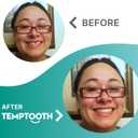 Temptooth Tooth Replacement Product with Coloring Material