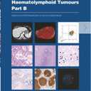 WHO Classification of Tumours: Haematolymphoid Tumours, 5th Edition (PART B)