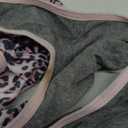 Kuoser Dog Recovery Suit, After Surgery Spay Neuter Onesie, Adjustable, Large, Pink, Polyester, for Medium Dogs (Large (Back:16.1-20.1'', Weight:23-48 LB), 4#Pink)