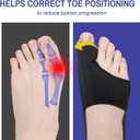 5 x 2 Pcs Bunion Corrector for Women & Men Big Toe Straightener-Bunions Correction Splint-Bunion Pads for Bunion Relief-Hallux Valgus Pain Relief,Comfortable Breathable for Day/Night Support (Light Black)