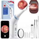 2026 Upgraded Electric Tonsil Stone Remover with 1080P Camera，Tonsil Stone Removal Kit with LED Light，900mAh Tonsil Stone Vacuum – Oral Care for Mouth Health & Painless Cleaning