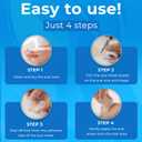 3 x Silicone Scar Sheets Roll (1.6"x158" 4m) - Reusable Waterproof Scar Tape, Strips for C-Section, Surgery, Keloid, Burn & Acne Scars Removal