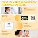 2026 Pore Vacuum with Camerafor, USB Rechargeable Blackhead Remover Vacuum,3 Levels Adjustable Pore Vacuum Blackhead Remover, 2Suction Heads,Face Vacuum Pore Cleanser for Women & Men-White