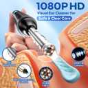 Ear Wax Removal Tool Camera, 1080P HD Ear Camera & 6 LED Lights, Easy and Safe Ear Cleaner for Kids & Adults, Ear Cleaning Kit Includes 8 Ear Tips and 7 Traditional Tools for iPhone, iPad, and Android