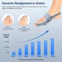 Bunion Corrector for Women & Men, Orthopedic Bunion Splint with Toe Separator, Adjustable Bunion Corrector for Bunion Relief, Suitable for Left and Right Feet (1)