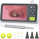 Anykit Digital Otoscope with Gyroscope, 4.5 Inches Screen, 3.9mm Ear Scope Camera with 6 Lights, Ear Wax Removal Tool, 32GB Card, Supports Photo Snap and Video Recording (Green)