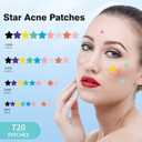 QUSTERE Pimple Patches for Face, Hydrocolloid Acne Patches, Cute Star Zit Covers, Colorful Spot Stickers with Tea Tree, Salicylic Acid & Cica Oil| 4 Sizes (8mm, 10mm, 12mm & 14mm) | 720 Count