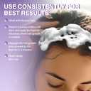 5% Minoxidil Foam for Women