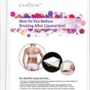 ContourMD Medical Grade Post Lipo Foam Compression Sheets  Post Surgery Compression Garment after Liposuction, Tummy Tuck, AB Flattening, BBL, & More  Surgery Recovery Supplies (3-Sheet Set) (8x11 Inch (Pack of 3))