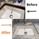 Complete Sink Repair Kit System-Undermount Sink Installation Kit- Bracket for kitchen (Patent)