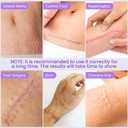 Silicone Scar Sheets, Silicone Scar Tape, Medical Grade Scar Tape for Surgical Scars, Keloid Bump Removal C-Section, Stretch Marks,Tummy Tuck, Hypertrophic, Post-Surgery-1.6"X 118" Roll, 3M