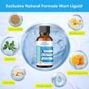 Fast Acting Liquid Wart Corn Callus, Plantar Wart Corn Remover Freeze Off for Feet: Exclusive Formula 17% Salicylic Acid Wart Freeze Off for Plantar Wart, Common Wart, Flat Wart, Corn 30ml.