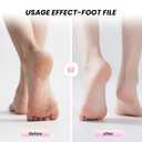 Cordless Electric Foot Callus Remover, 2-in-1 Rechargeable Callus Remover & Nail Polisher, 6 Speeds with 40 Sanding Heads, 1200mAh Long-Lasting Battery, Ergonomic Handle for Home & Travel Use