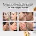 CLEARSTEM - MINDBODYSKIN Hormonal Acne Supplement (5-HTP) - Natural DIM Supplement - Skin Care Vitamins - Hormone Balance, Antioxidants - Gluten Free, Cruelty Free - 30 Servings, 90 Capsules