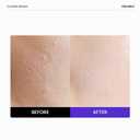 FRANKLY Closer Serum Jumbo | Pore Minimizer Serum | 9 Peptides, Vegan Collagen, Adenosine, PHA | Korean Pore Minimizer for Glass Skin, Anti-Aging, Hydration, Elasticity | 2.03 fl oz