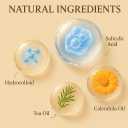 Pimple Patches for Acne (300 Count, 4 Sizes)  Hydrocolloid Zit Stickers with Salicylic Acid, Tea Tree & Calendula  Invisible Overnight Acne Patches for Fast Healing & Clear Skin