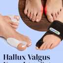 YOGAMEDIC Bunion Corrector for Men & Women - One Size - 4pcs, 2 Splints & 2 Silicone Spacers - Adjustable Day & Night Wear - Anatomical Foot Alignment, Soft Gel Toe Separators for Daily Support and Nighttime Use