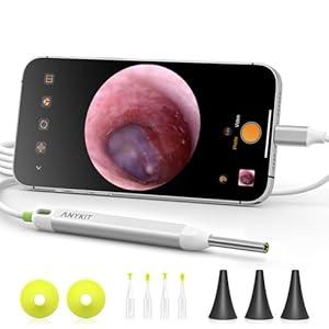 Anykit Digital Otoscope with Gyroscope, HD Ultra Clear View Ear Camera with Ear Wax Removal Tools, Video Ear Scope Otoscope with Light, Compatible with Android, iPhone 15 (Silver)
