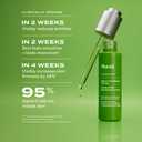 Murad Retinol Youth Renewal Oil Drops Anti-Aging Retinol Facial Oil with Omega-Rich Oils Hydrates, Smooths Fine Lines & Wrinkles Lightweight, Fast-Absorbing Skincare Treatment 1.0 oz