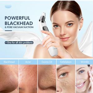 Blackhead Remover Pore Vacuum, Upgraded Black Head Remover for Face, Electric Acne Comedone Whitehead Extractor Tools-5 Suction Power, USB Rechargeable Pimple Popper Tool Kit