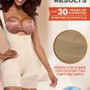 Sonryse Tummy Tuck Compression Garment for Women Fajas Colombianas Reductoras y Moldeadoras Stage 2 Faja (Beige)