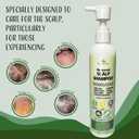 Recuren Plus Scalp Dandruff Shampoo: Scalp Dandruff– with Salicylic Acid, Piroctone Olamine, Rosemary & Coconut Oil