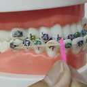 Chargenyang Dental Elastic Rubber Bands Placers for Braces Disposable Plastic Orthodontic Elastic Placers Multi-color (60PCS)