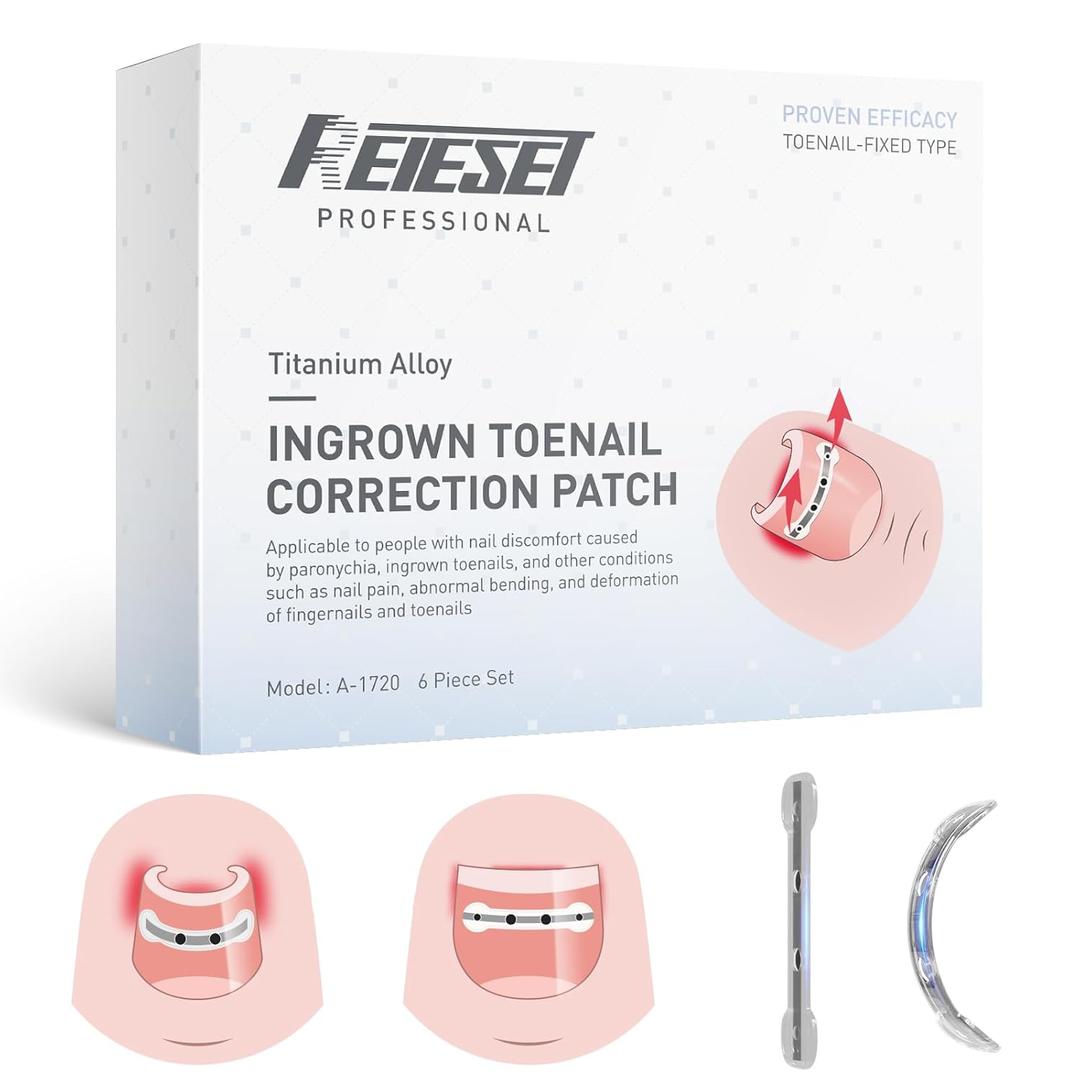Titanium Alloy Ingrown Toenail Treatment, Nail Tools, and Ingrown Toenail Removal Kit Specially Designed for Curved Nail Repair and Ingrown Toenail Corrector (0.59/0.67in) Titanium Alloy Ingrown Toenail Treatment, Nail Tools, and Ingrown Toenail Removal Kit Specially Designed for Curved Nail Repair and Ingrown Toenail Corrector (0.59/0.67in)