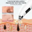 Facial Pore Blackhead Remover Vacuum - Fore Cleaner and Blackhead Extractor with 3 Adjustable Suction Levels - 5 Probes - Pore Vacuum Kit for Women&Men (White)