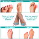 4 x Toe Separators Bunion Corrector - Toe Spacers Yoga Toes Separators for Foot Pain Relief for Hammertoes - Toe Stretcher for Men and Women - 1 Pair - Blue