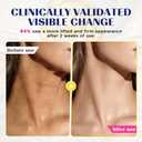 Neck Firming Cream with Roller - Infused with Peptides, Collagen, Hyaluronic Acid & Ceramides, Anti-Aging Neck & Chest Cream to Smooths Wrinkles and Fine Lines (5.29 Ounce (Pack of 1))