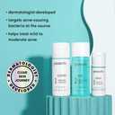 Proactiv 3 Step Acne Treatment - Benzoyl Peroxide Face Wash, Repairing Acne Spot Treatment for Face and Body, Exfoliating Toner - 30 Day Complete Acne Skin Care Kit