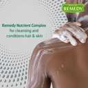 Medline Remedy Specialized No-Rinse Foam Cleanser, Gentle Skincare Solution, 8 oz. Bottle