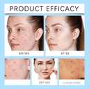 5 x Facial Cream for Women & Men, 30g